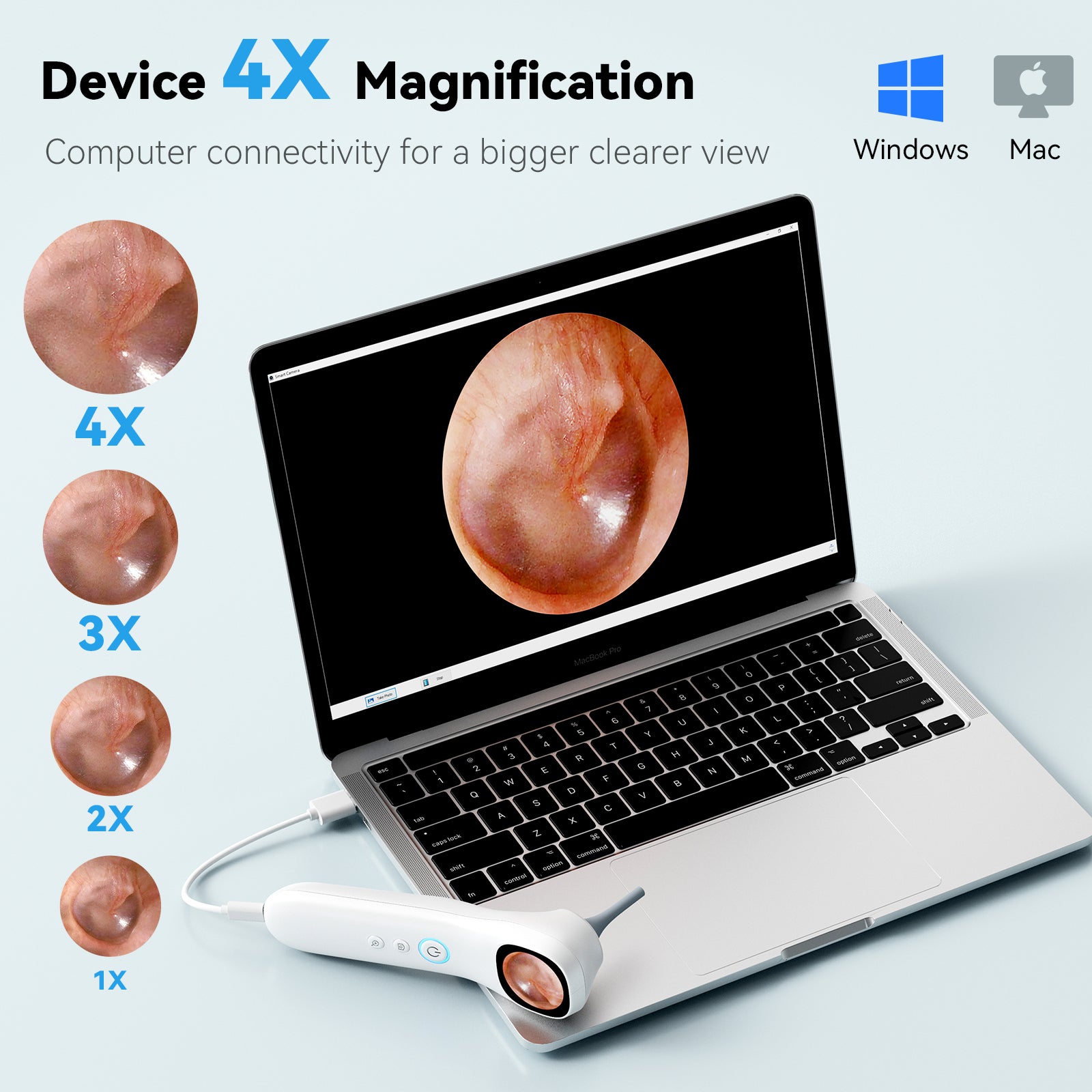 Smart Ear Wax Removal Tool — 5-in-1 Digital Otoscope with Camera & Display