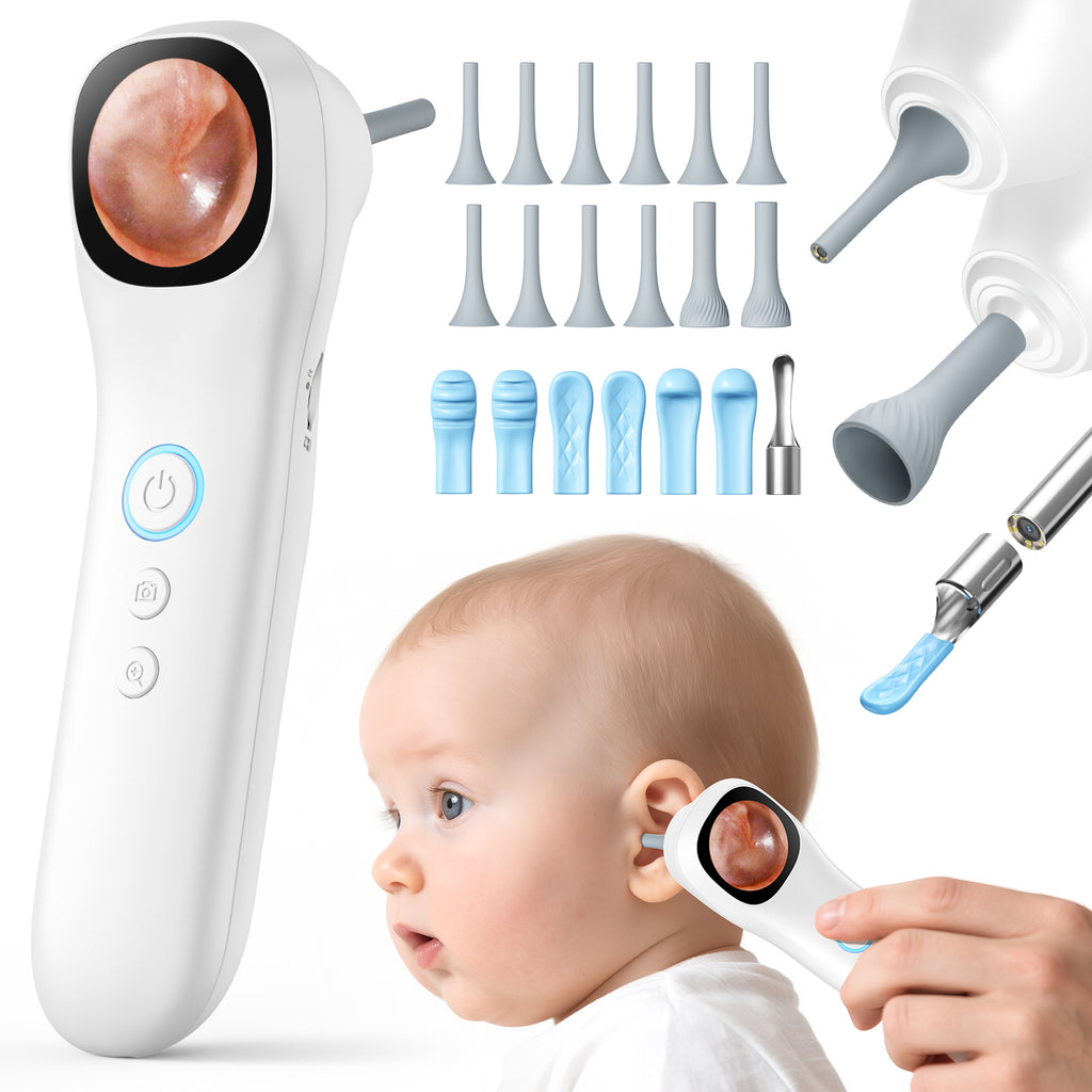 Smart Ear Wax Removal Tool — 5-in-1 Digital Otoscope with Camera & Display